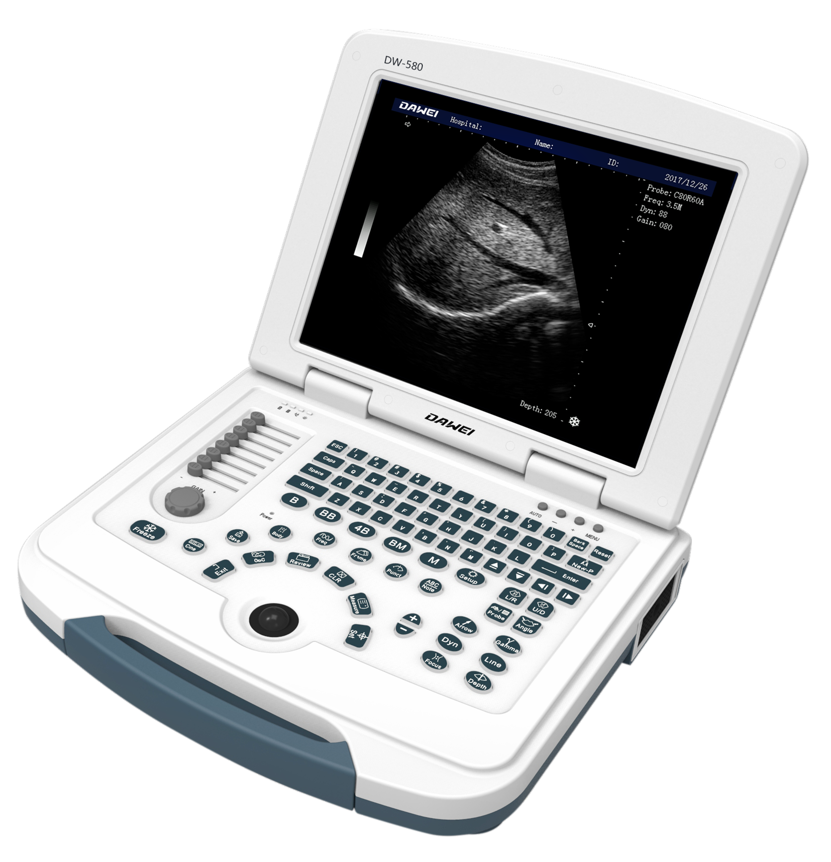 Portable Ultrasound Machine Dw580