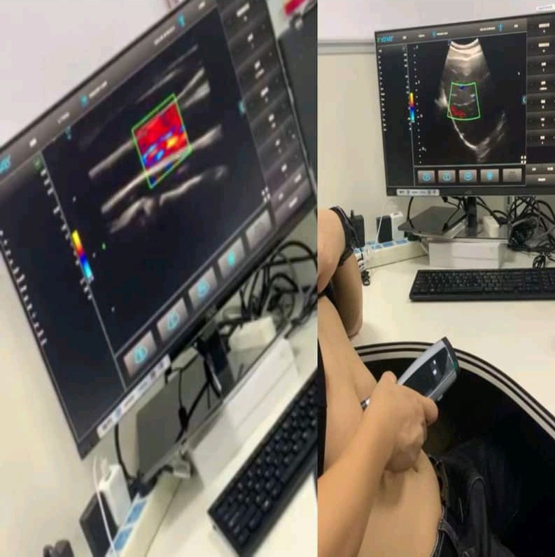 Colour doppler ultrasound scan studio set