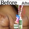 Rhabs aloe vera skin repair set