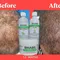 Rhabs aloe vera hair growth (baldness set)